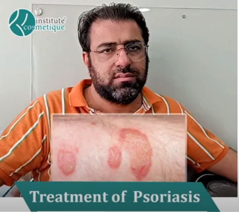 Patient Testimonial | Best Treatment of Psoriasis in Pakistan 